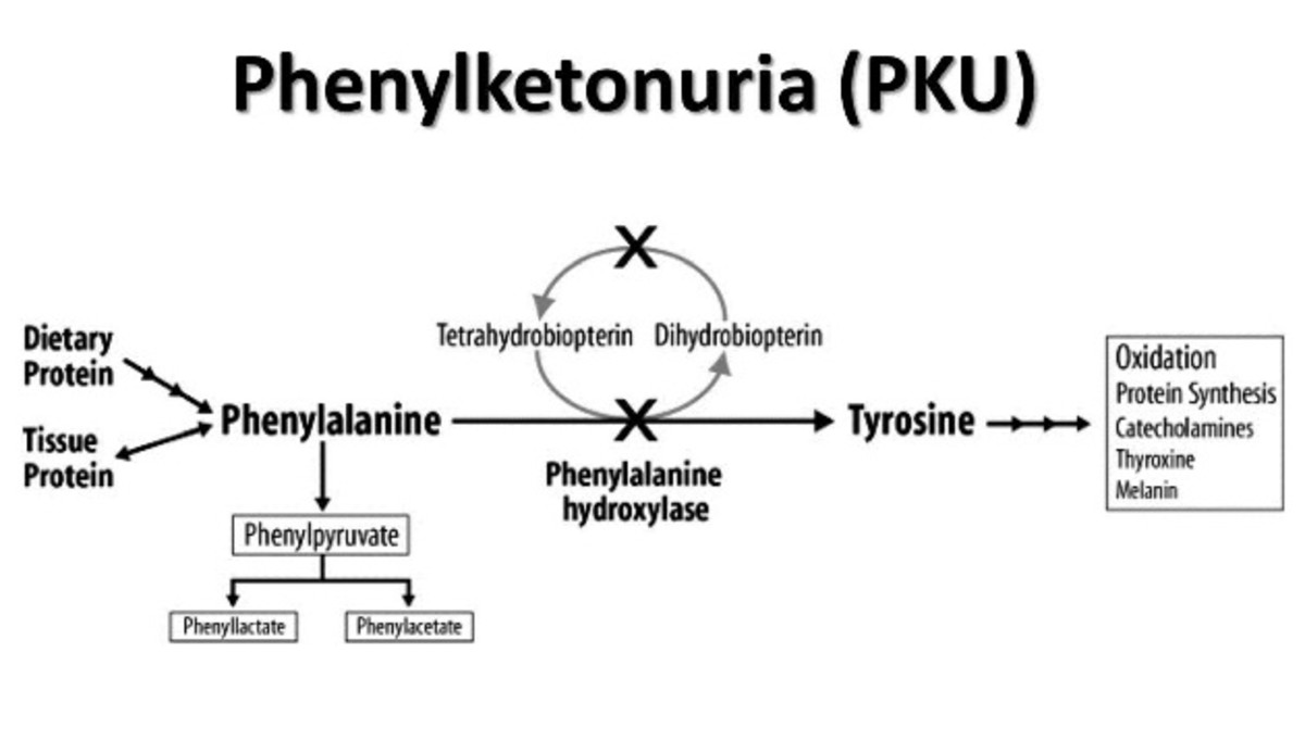 Phenylketonuria Diagram