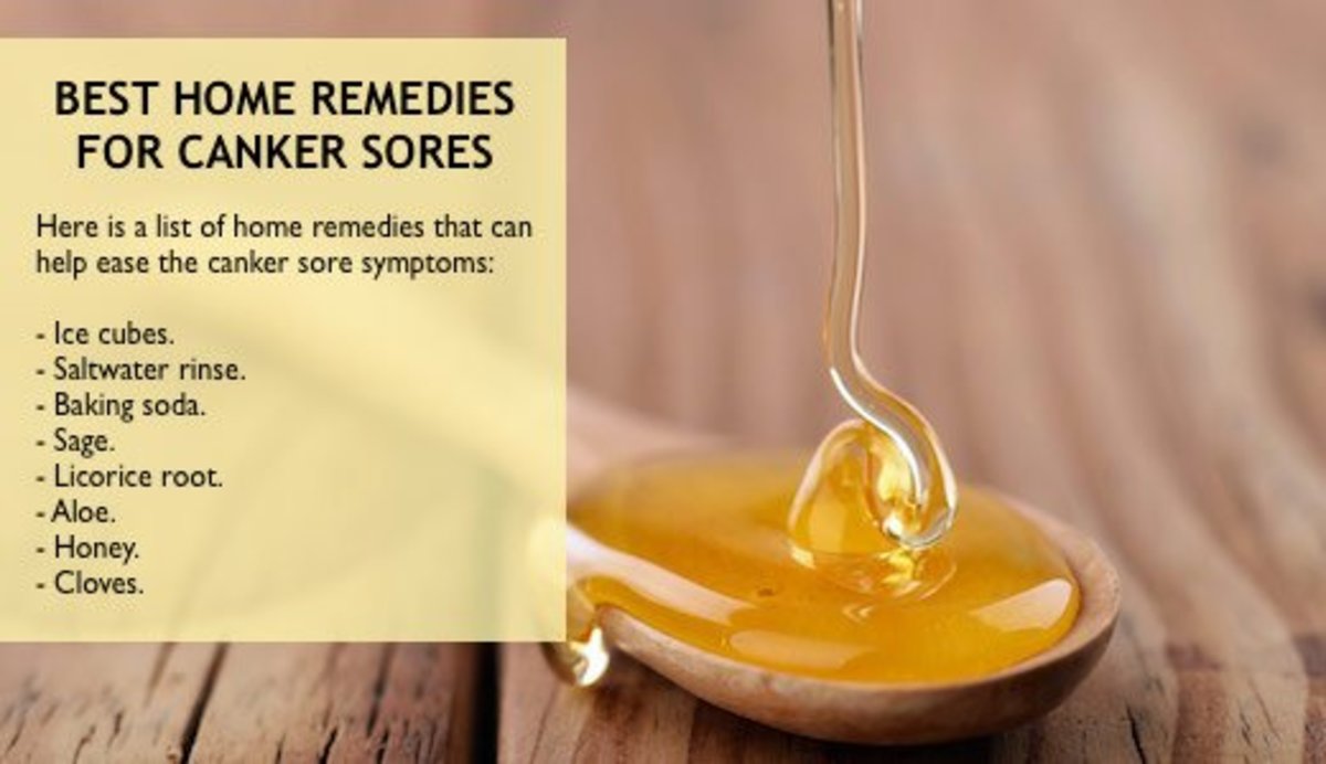 A list of most popular canker sore home remedies.