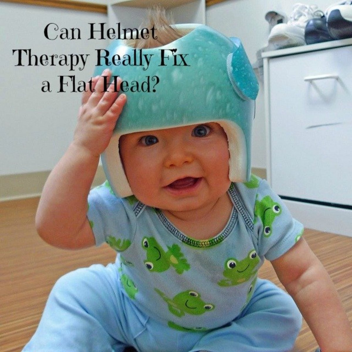 Why do babies wear helmets?