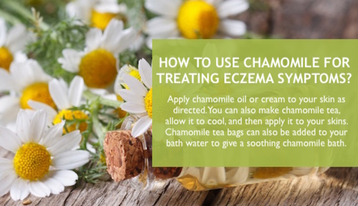 Chamomile as a remedy for eczema symptoms