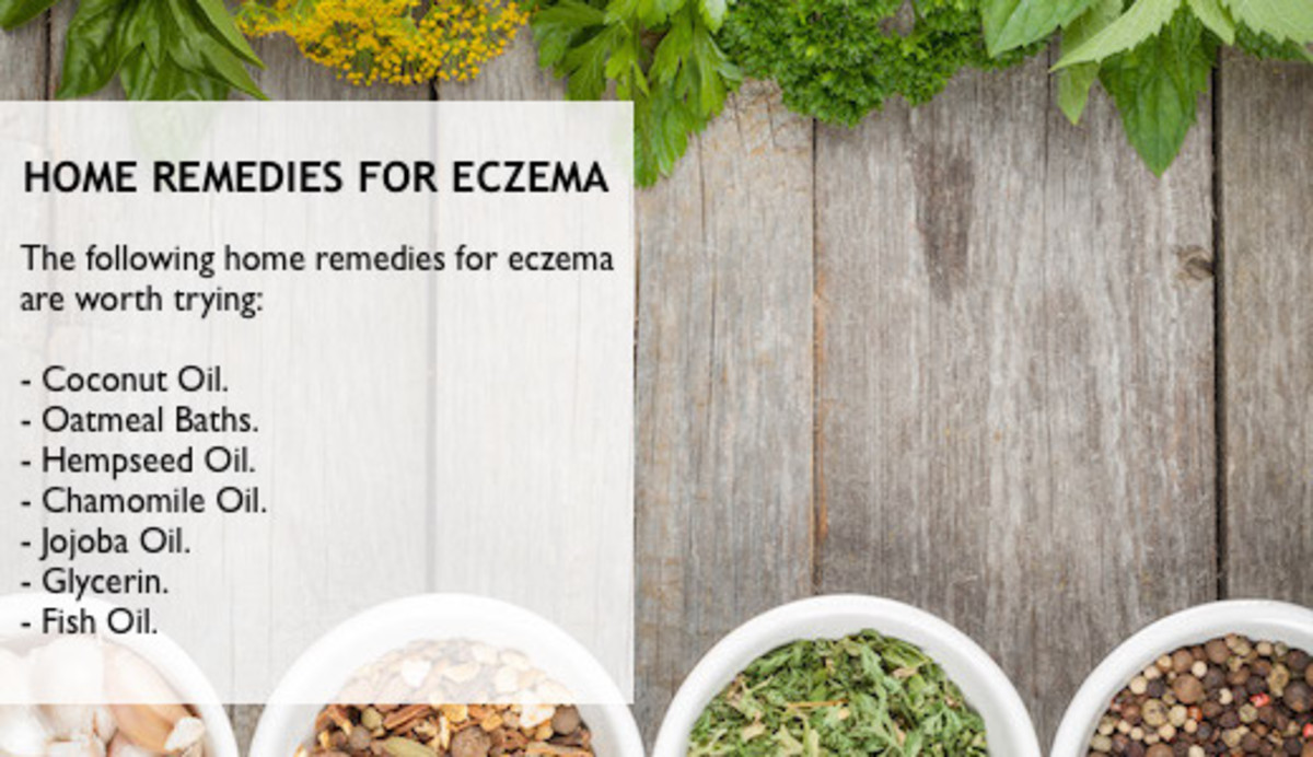Effective home remedies for eczema