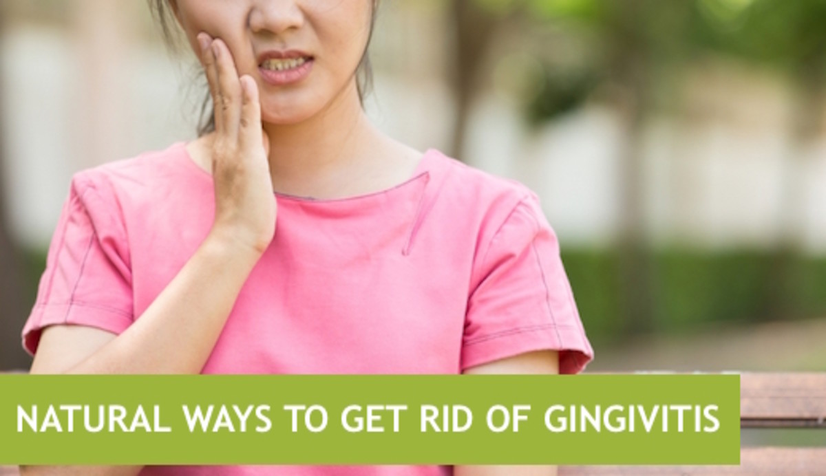 7 Natural Treatments for Gingivitis