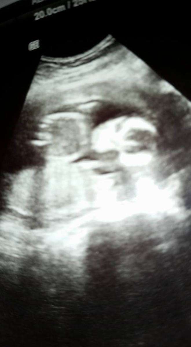 Baby Morgan in utero at 4 months