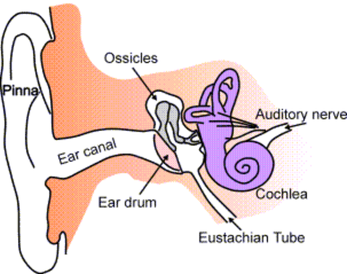 Damage to the cochlea, shown in purple, is the most common cause of tinnitus. Loud noise can damage the cochlea.