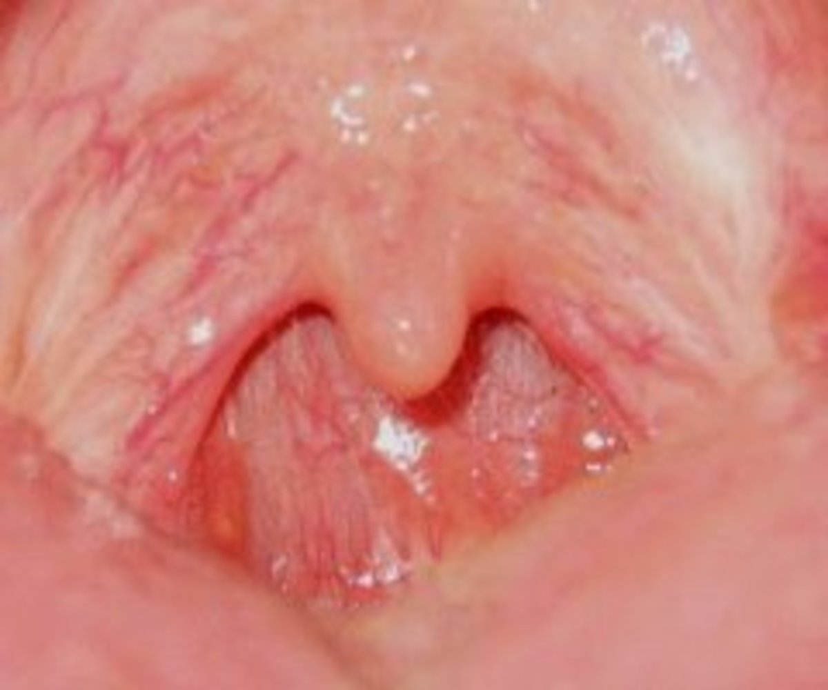 A healthy, tonsil-free throat!