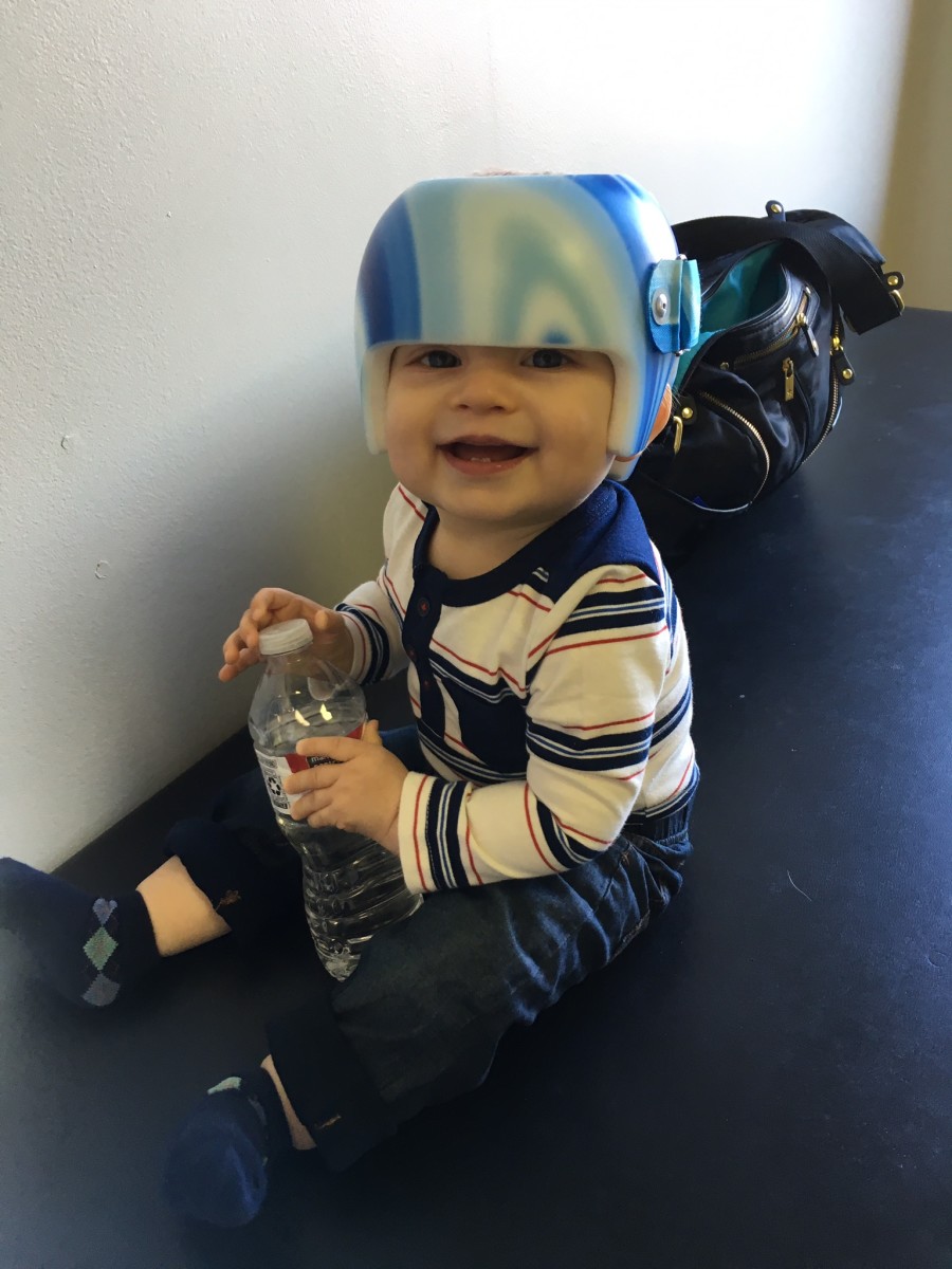 Helmet Therapy for Babies My Son's Story Patient's Lounge