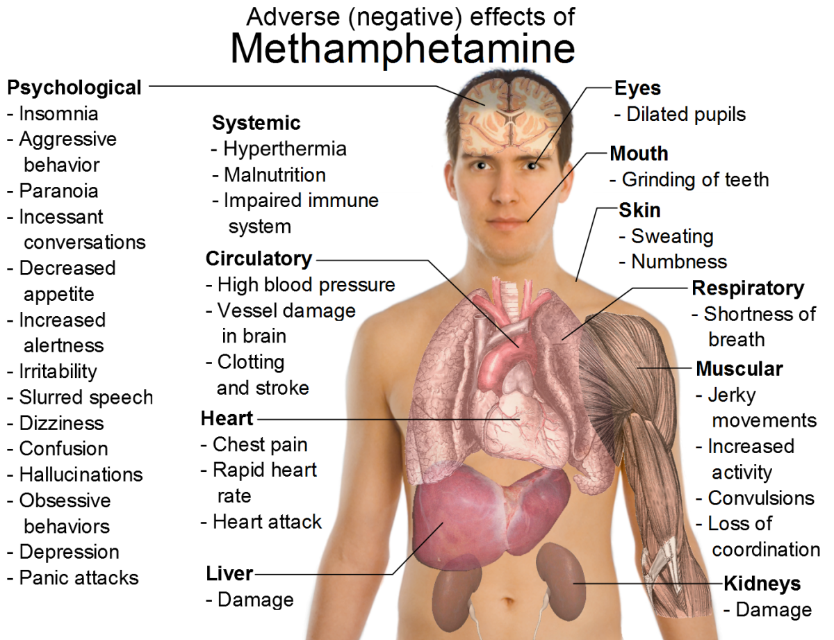 A visual diagram of the impacts of methamphetamine use.