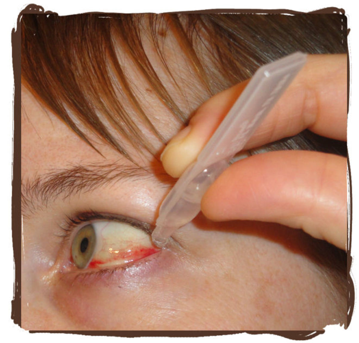 Since the broken blood vessel caused my eye to feel dry, and a little scratchy, the eye drops helped a little.