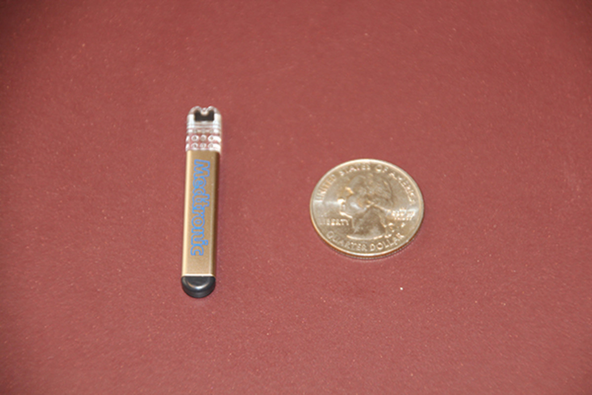 The loop recorder is about the size of a quarter.