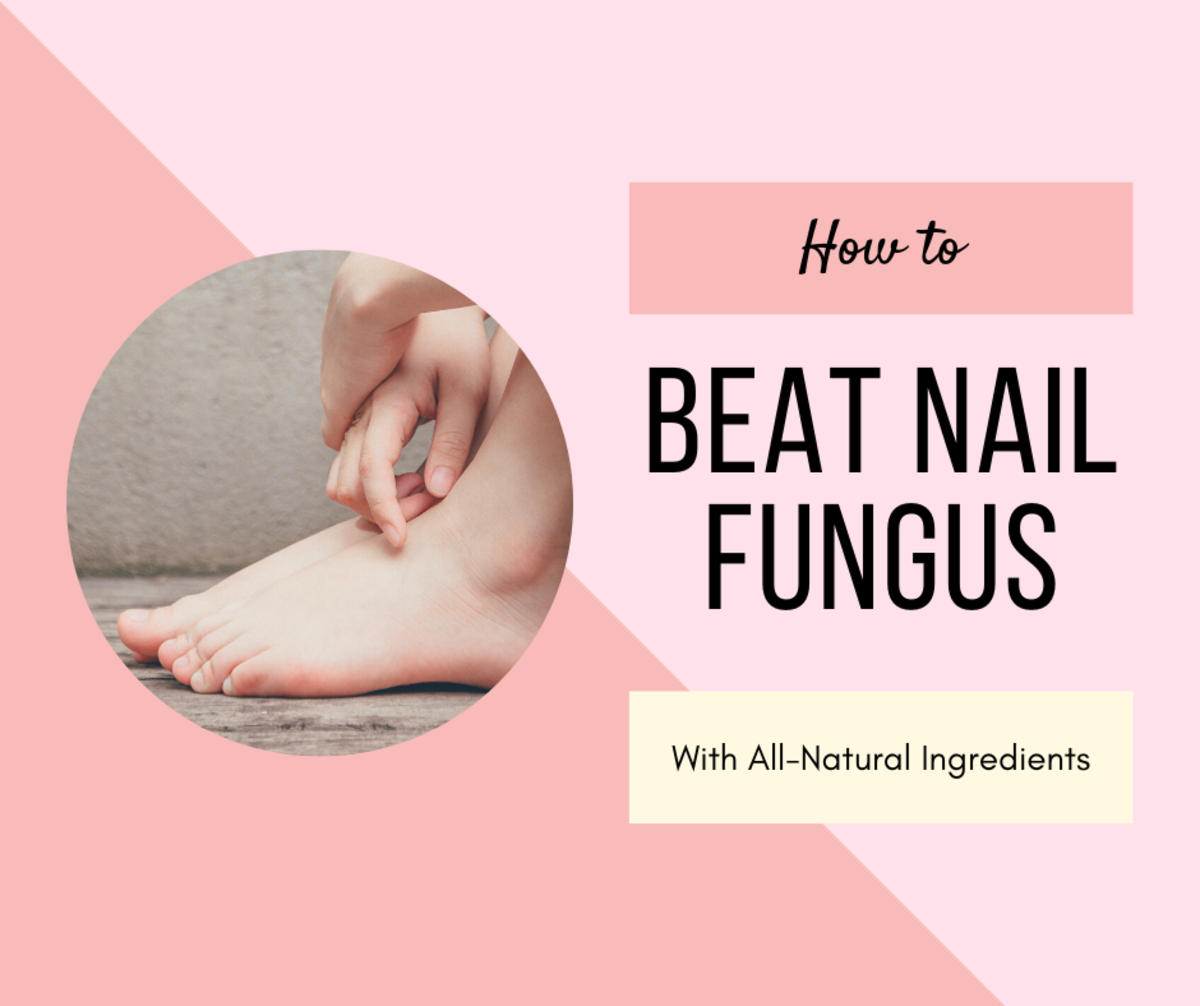 Read on for 10 ways to beat nail fungus the natural way! 