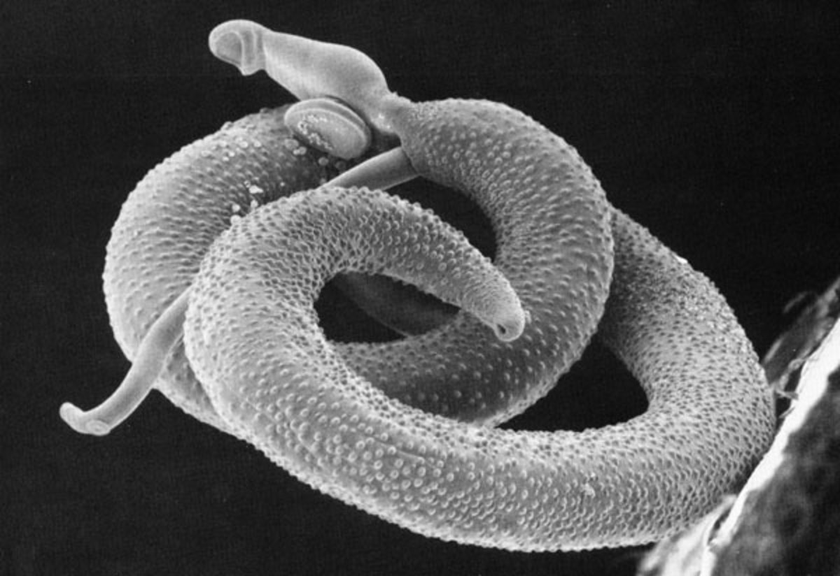 Life History of the Blood Fluke (Schistosoma sp.)