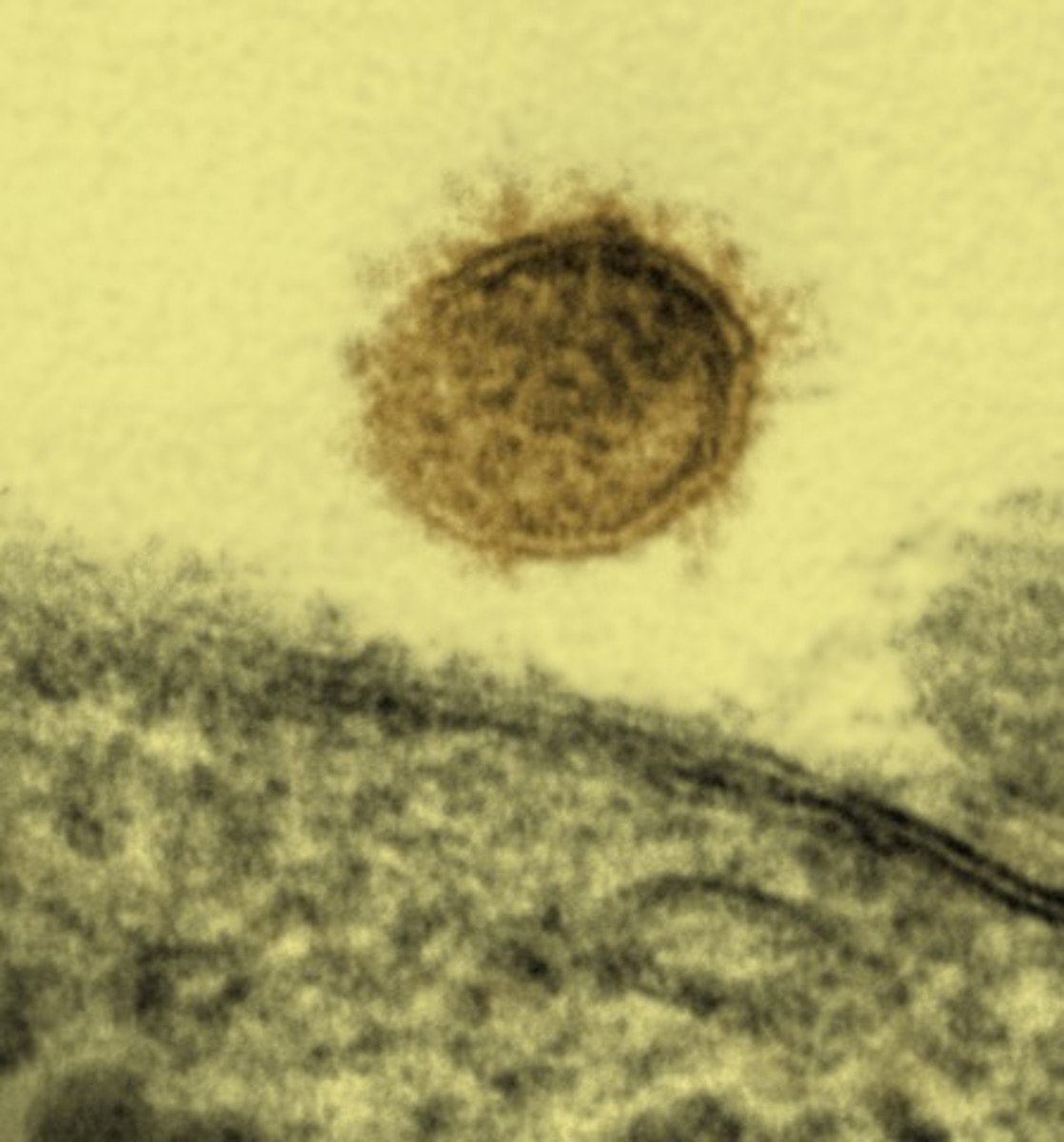 A Sin Nombre virus particle shown budding from a Vero cell. This virus causes hantavirus pulmonary syndrome in North America. Credit: NIAID
