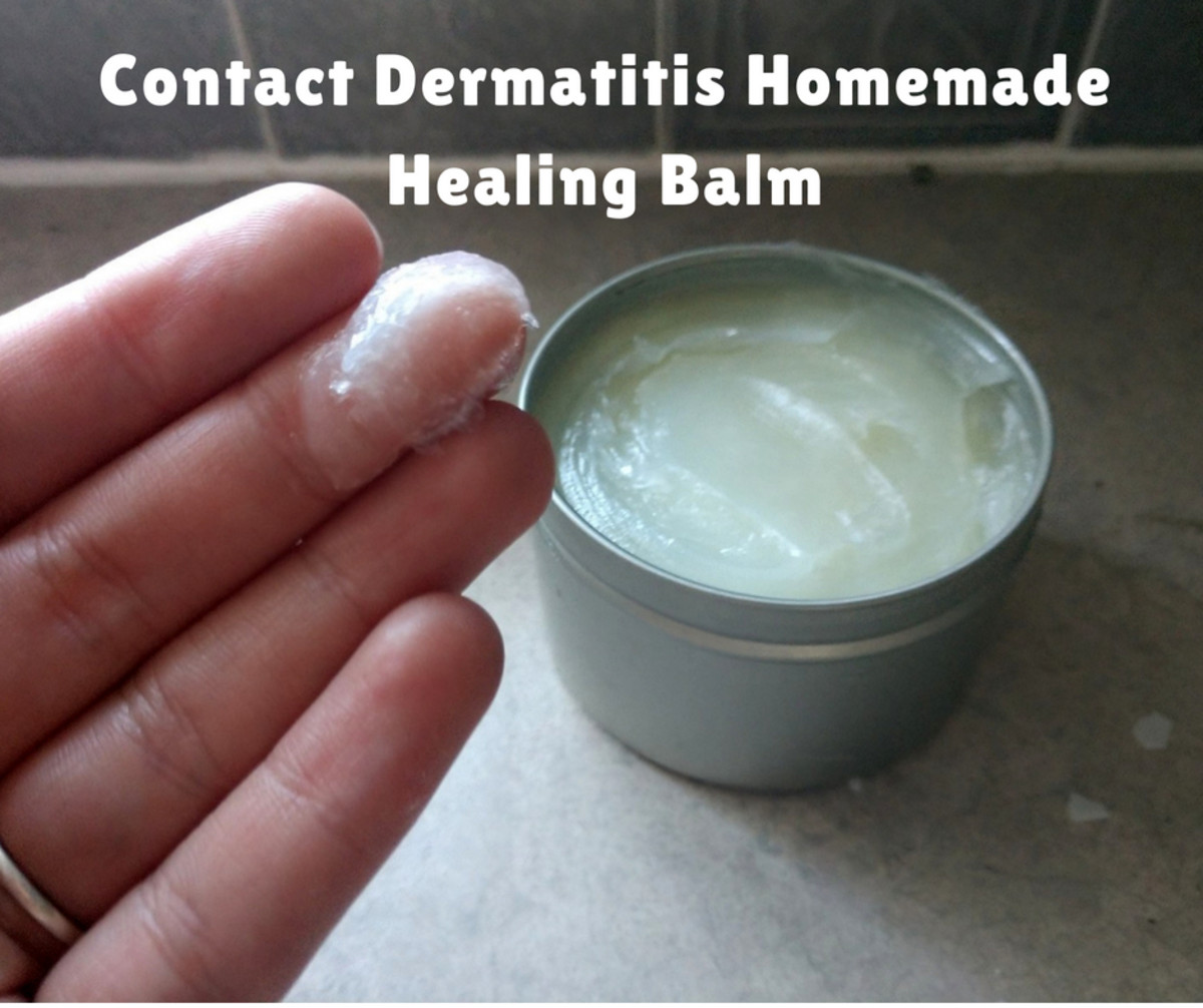 This homemade healing balm should help clear up your contact dermatitis. 