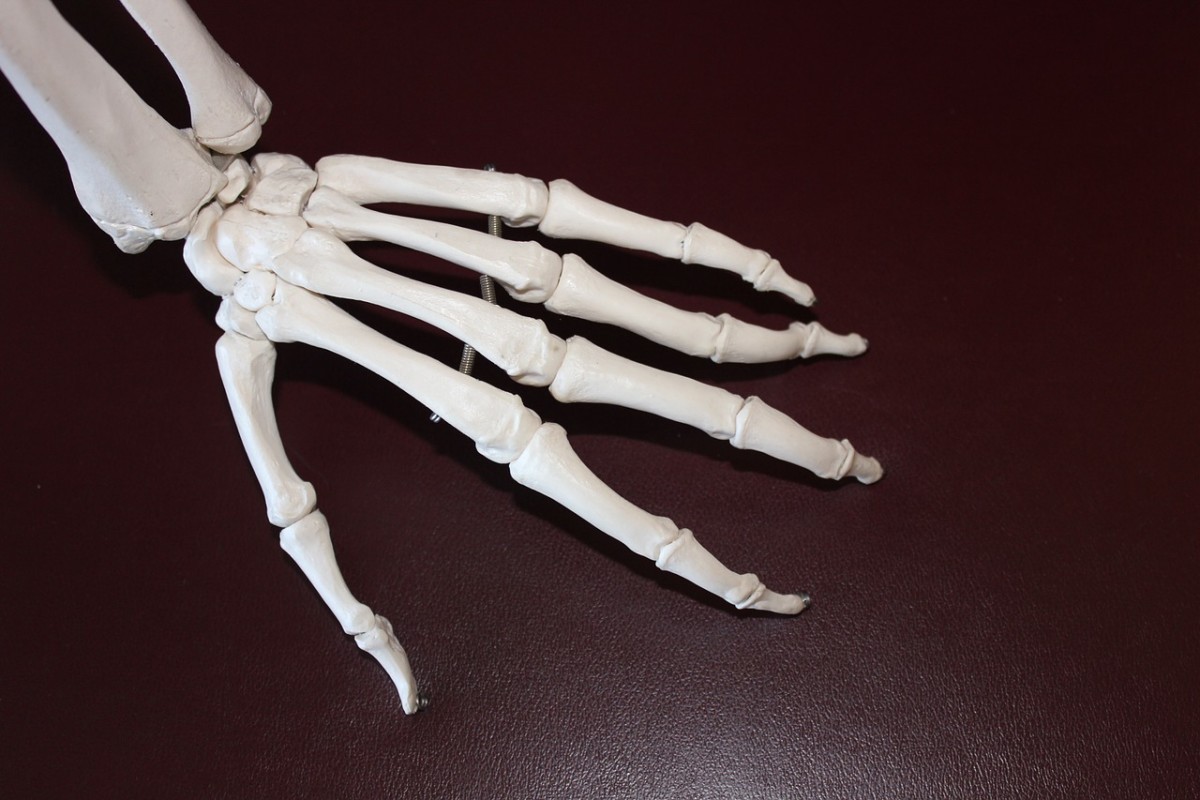 Arthritis in Fingers