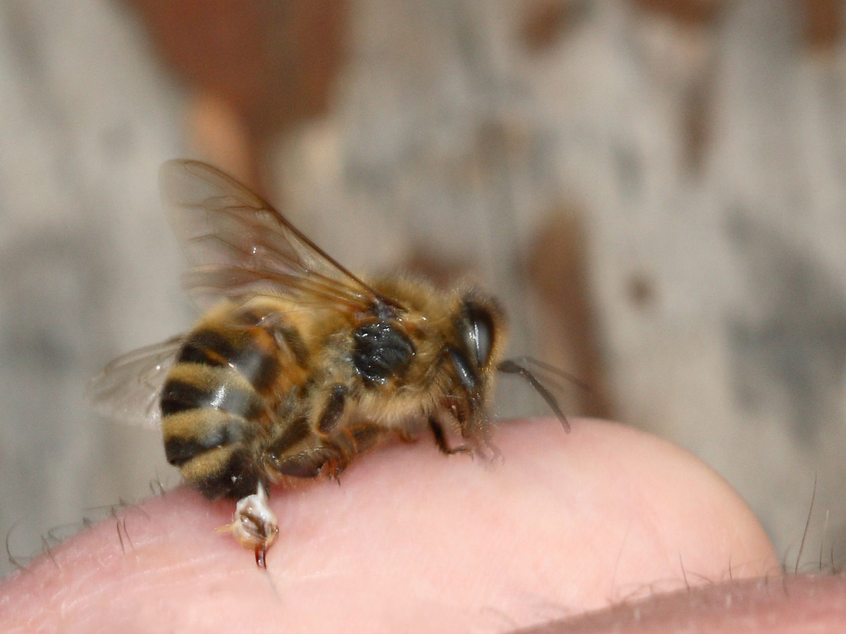 Picture Of Bee Stinging A Person