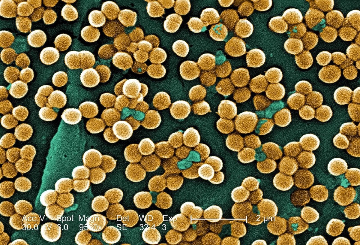 A colorized photo of MRSA cells