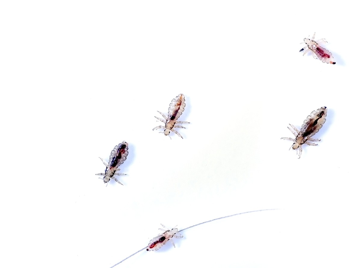 Head Lice on a white background.