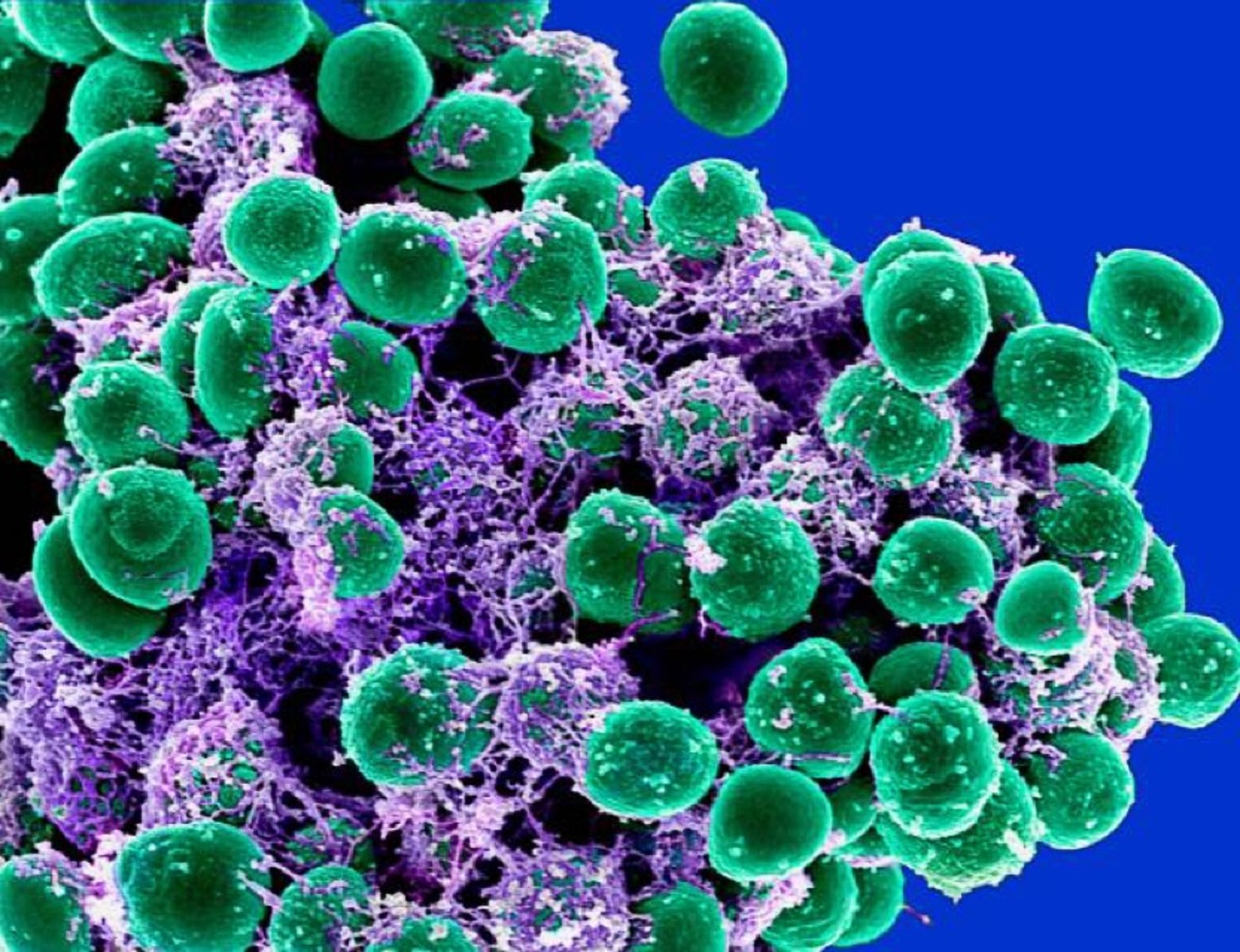 A colorized scanning electron micrograph of Staphylococcus epidermidis (green) and extracellular matrix (purple)