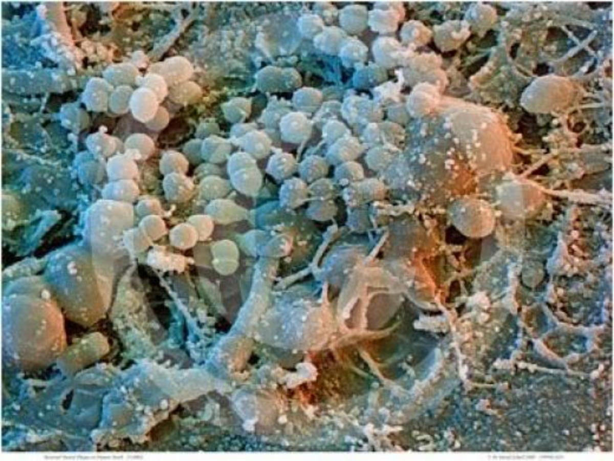 Biofilm (plaque) bacteria