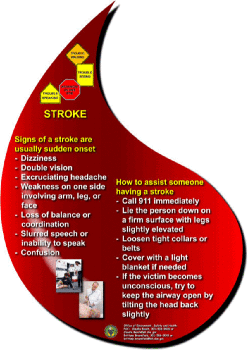 Signs of a stroke and what to do