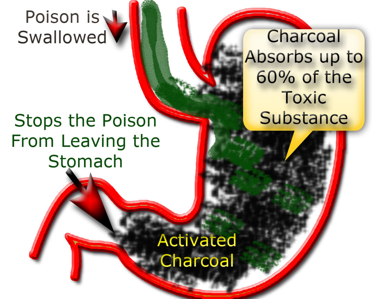 Here's how activated charcoal absorbs the poison in the stomach. 