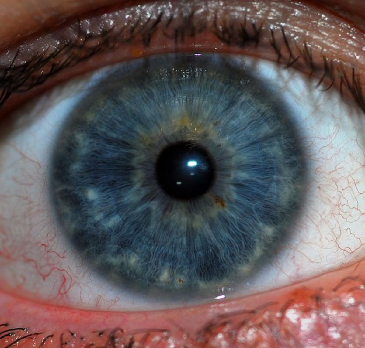 The normal undilated pupil