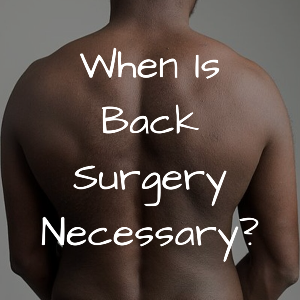 Is Surgery Necessary to Relieve Back Pain?