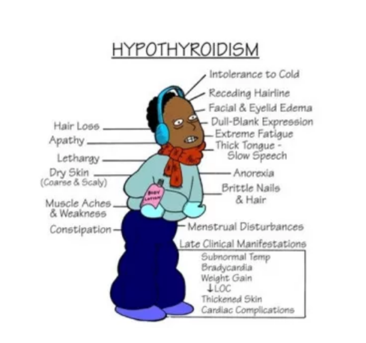 What Is Hypothyroidism And Is It Treatable Healthproadvice Free 