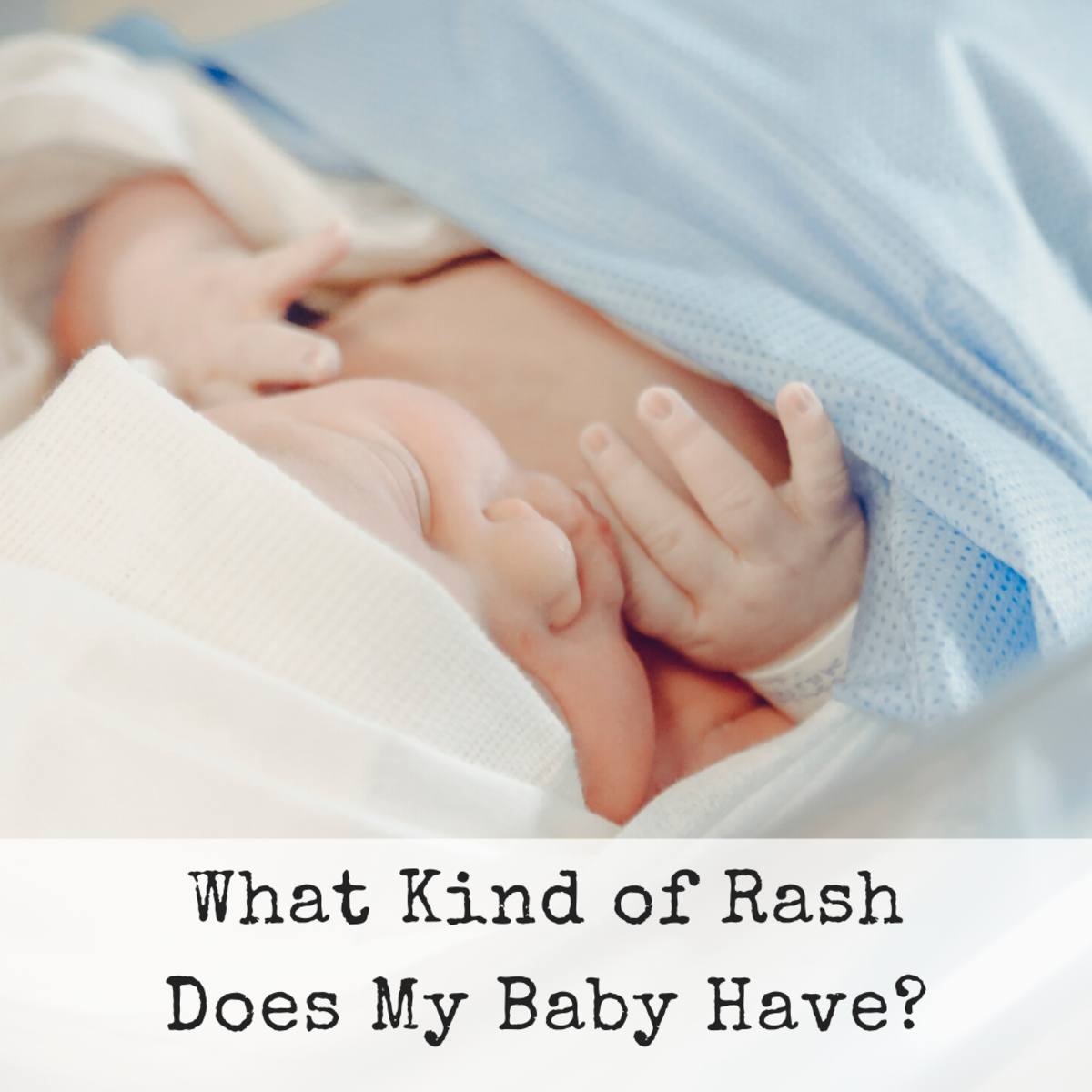 Discovering your infant has a rash can cause panic. What is it? Do you need to call a doctor? Here are four of the most common rashes. 