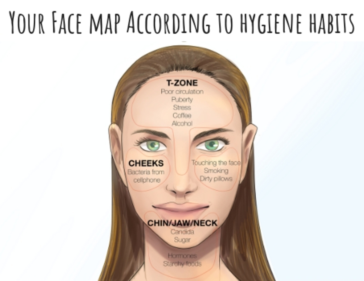 Sometimes, your hygiene habits can affect where you get breakouts on your face.