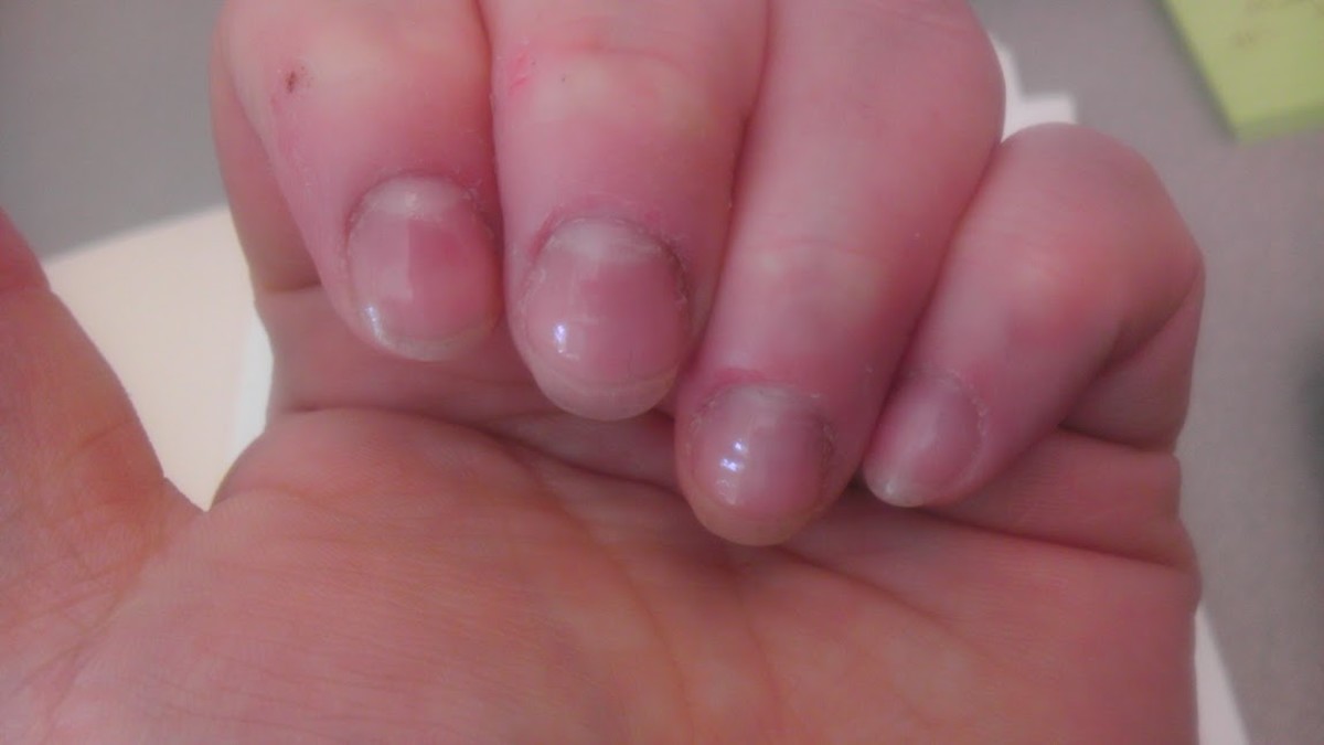 How to Stop Biting Your Nails and Cuticles! - Bellatory