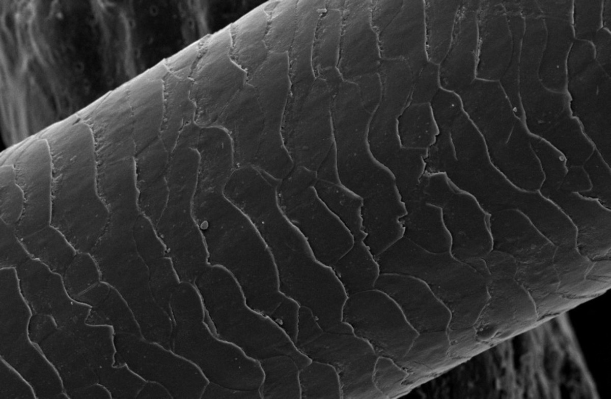 The scaly structure of a strand of hair as seen under an electron microscope.