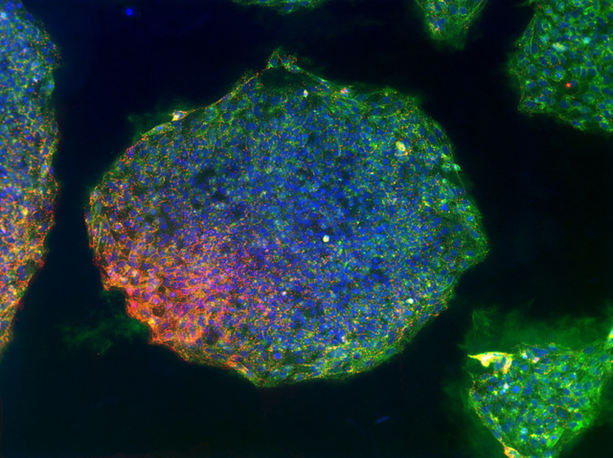 Pluripotent stem cell that can be generated directly from adult cells