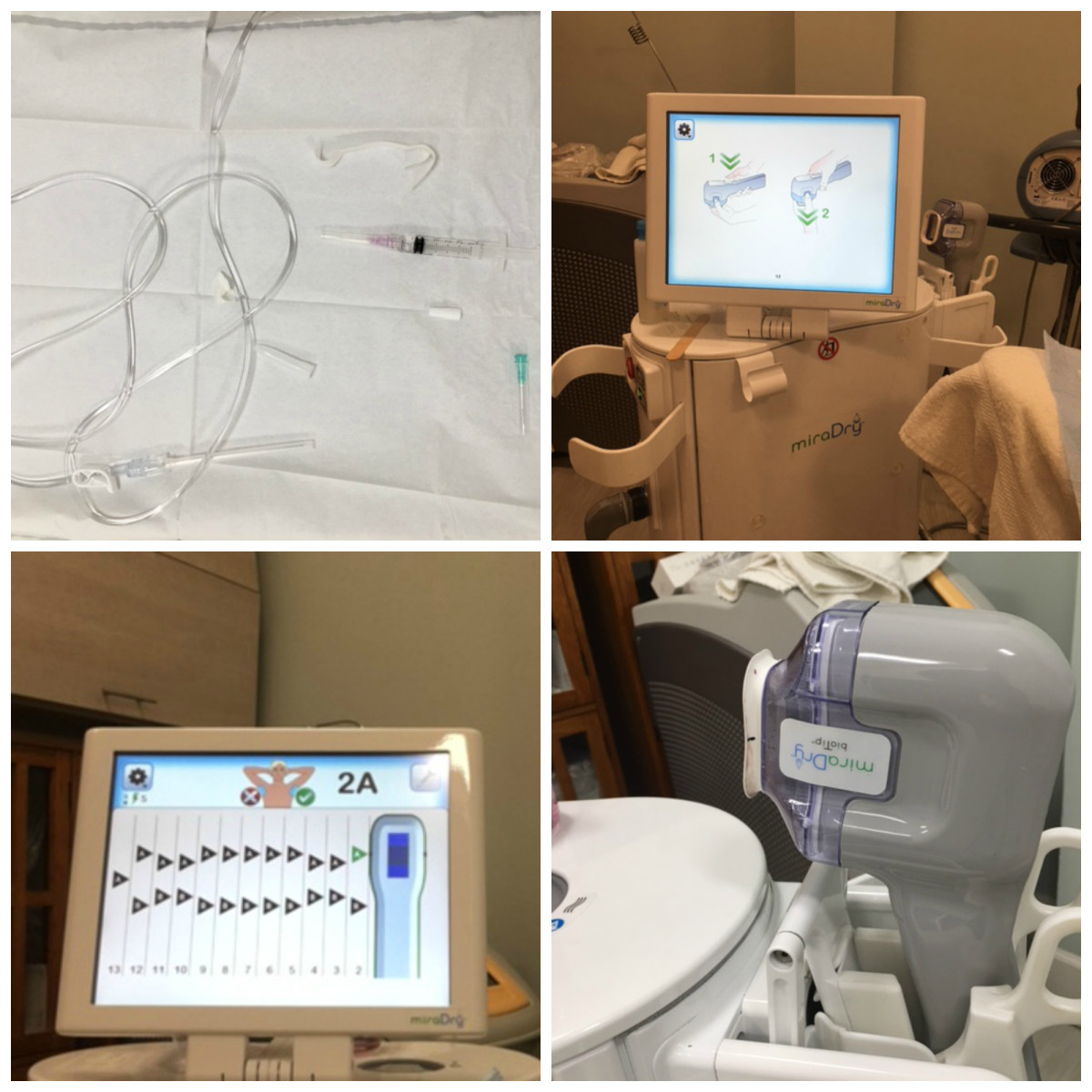 Top left: Elements of anesthesia Top right: Default screen of miraDry® Bottom left: miraDry® screen in action Bottom right: miraDry® "wand"