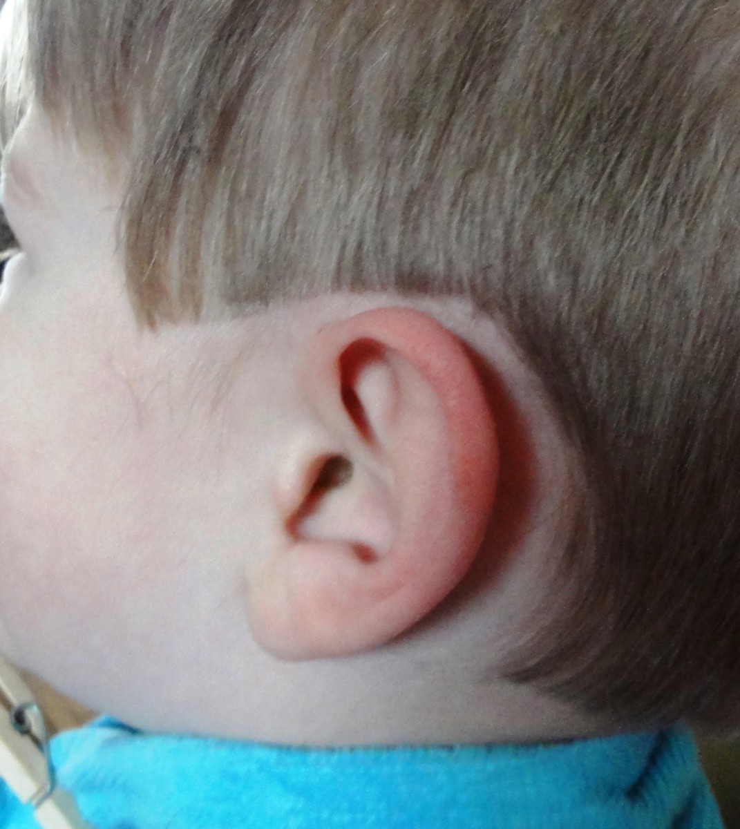 The neatened ear