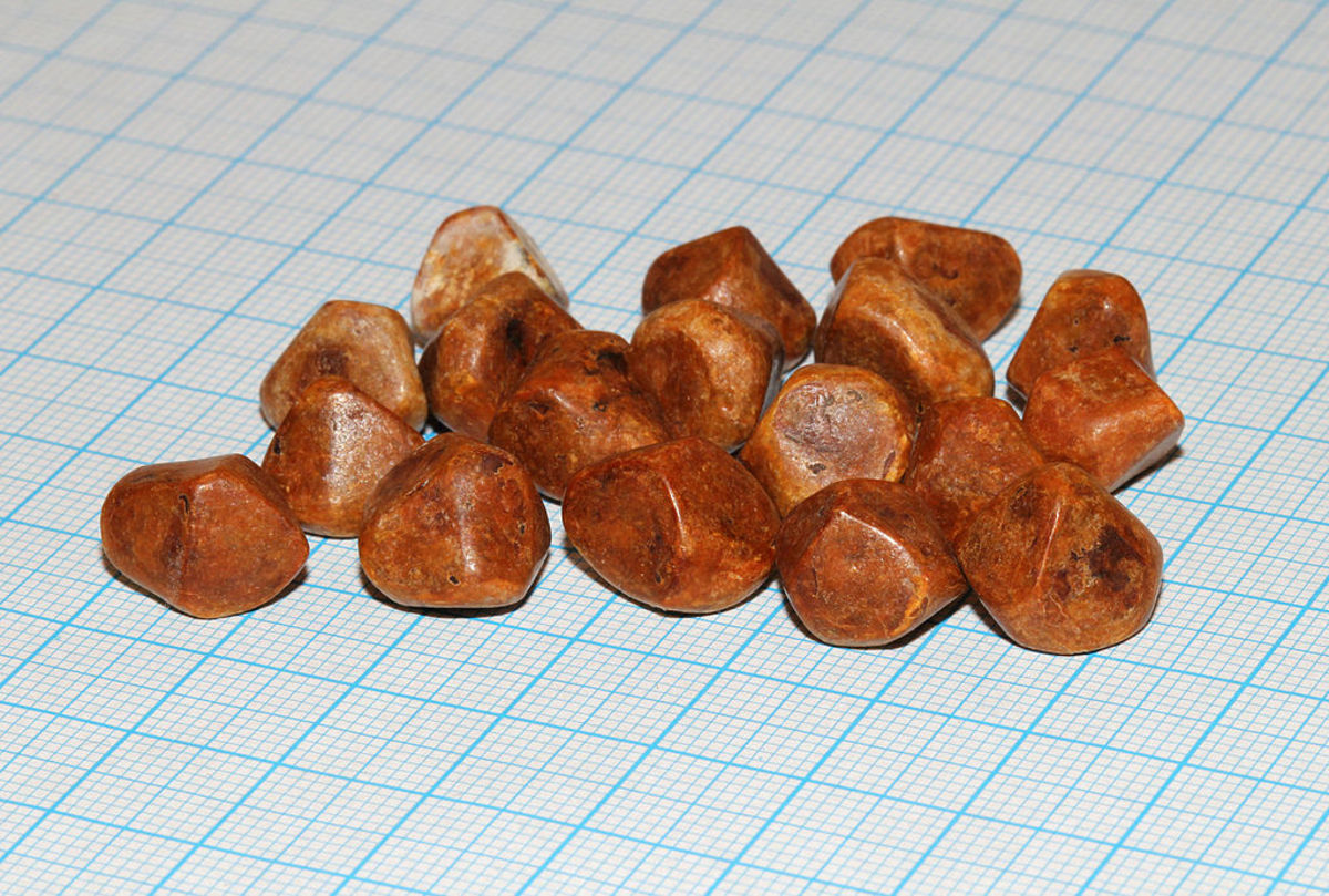 These are gallstones formed from cholesterol. For size reference, each grid is 1 mm.