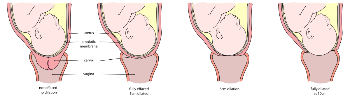 Cervix Effacement and Dilation: The cervix may begin to efface and dilate at this stage of the pregnancy.