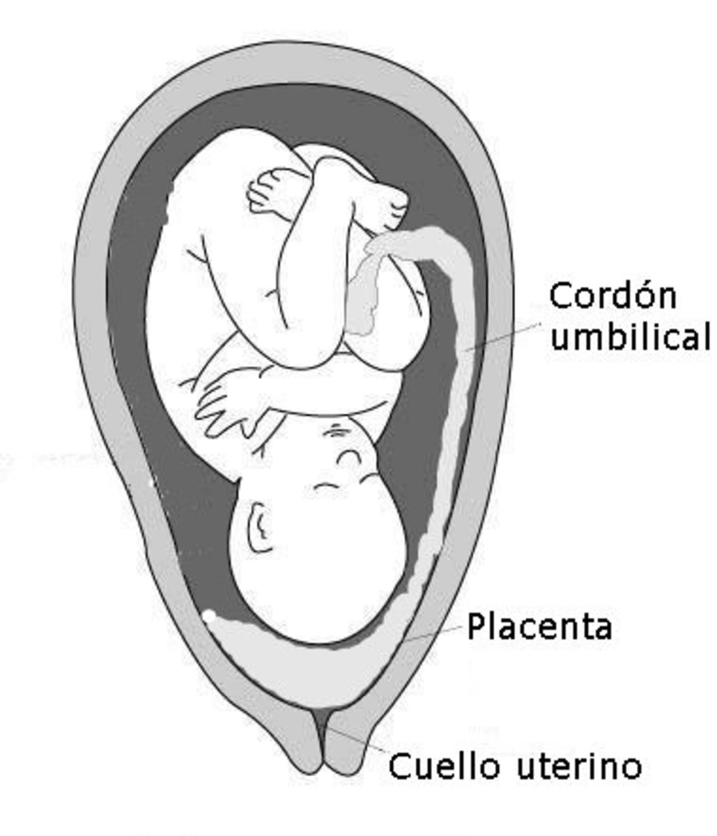 Placenta previa may cause bleeding during late pregnancy. Women should receive an ultrasound during the second trimester to identify this condition.