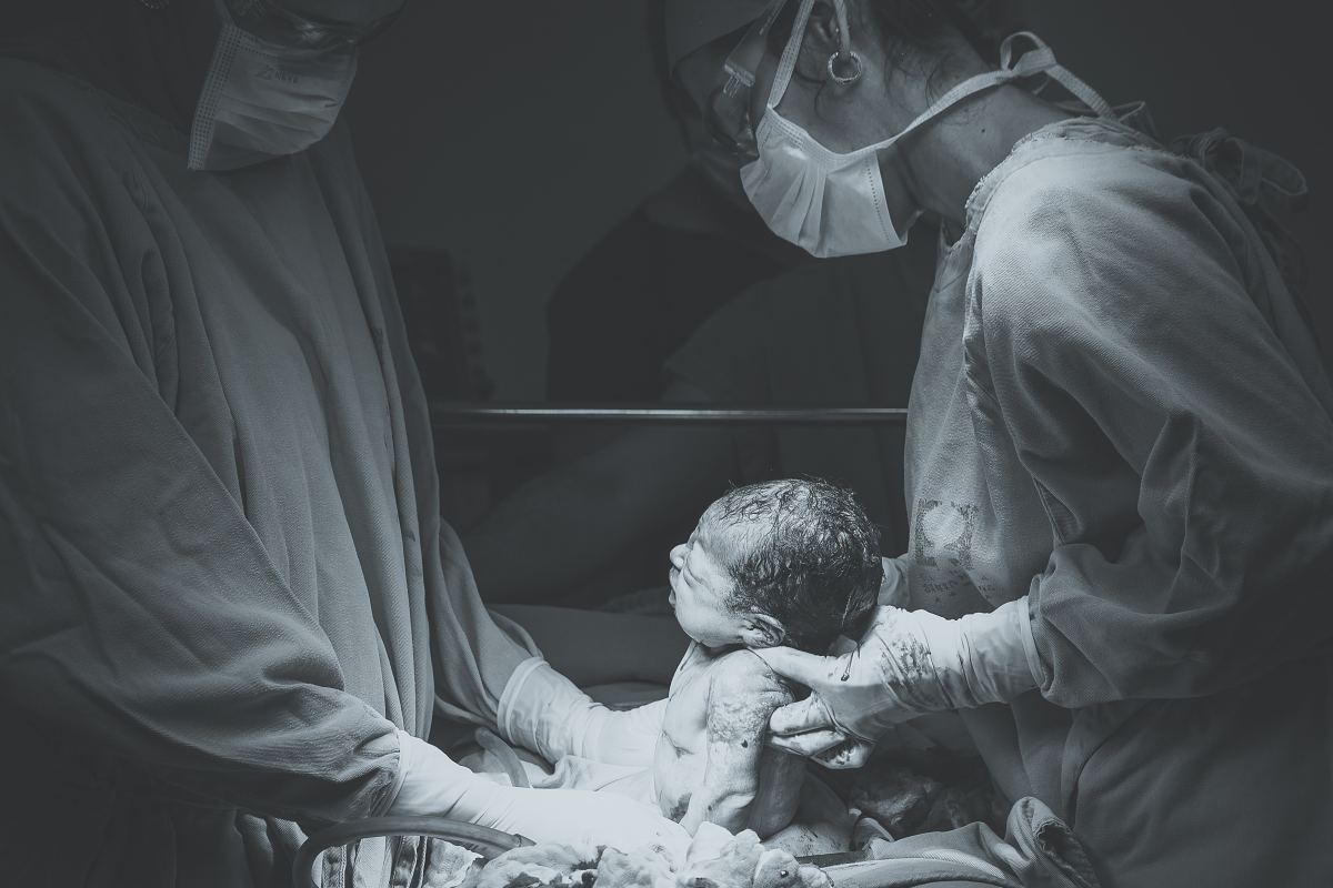 A baby being born via C-Section delivery