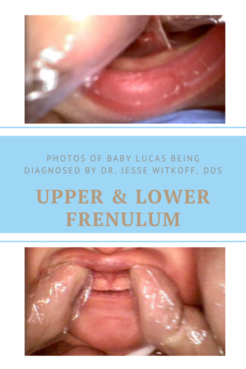 Photos of Lucas Being Diagnosed by Dr. Jesse Witkoff, DDS
