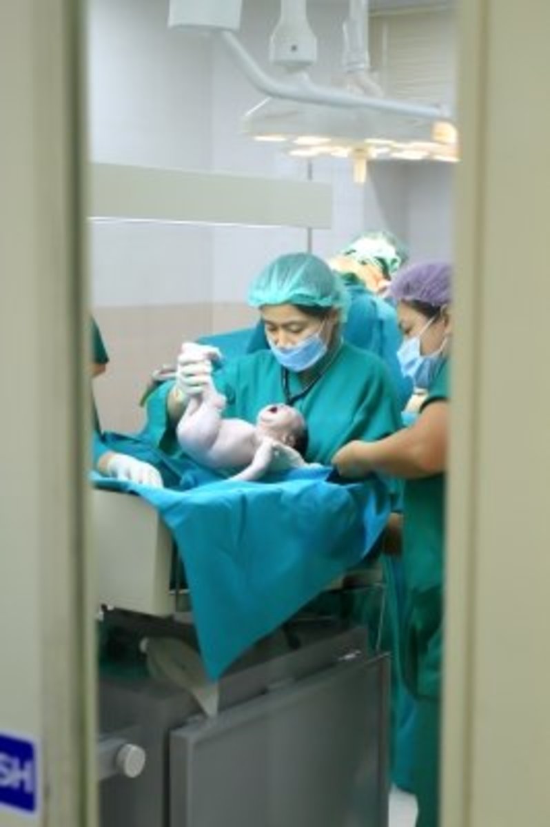 A newborn baby receiving intervention from NICU staff.