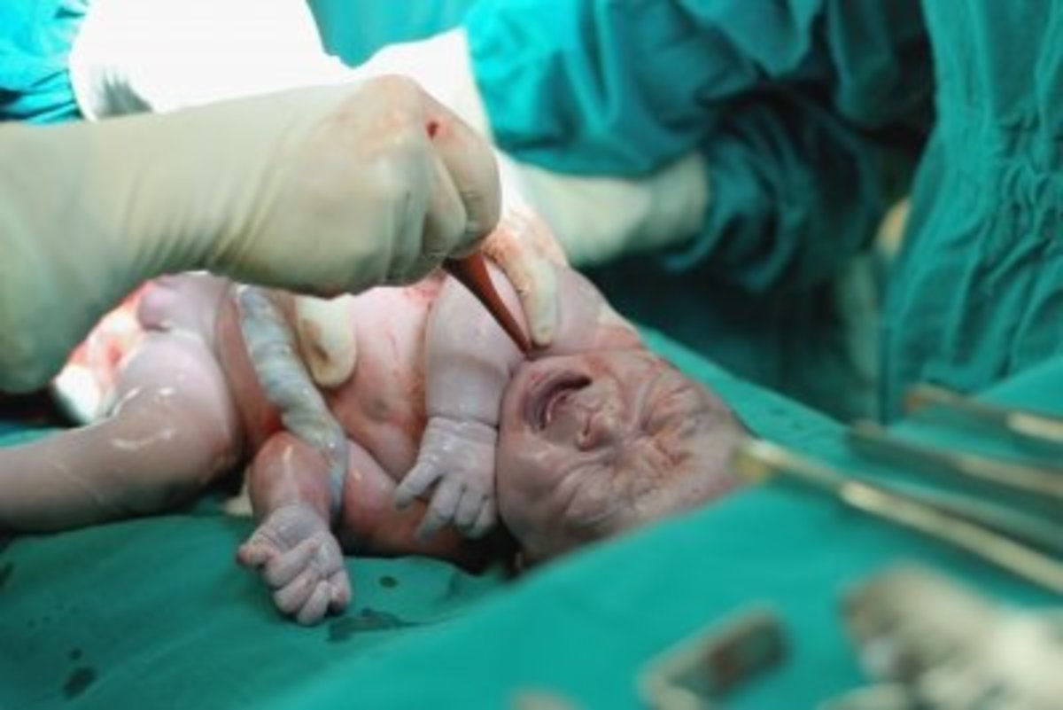 A newborn baby being suctioned by the nursing staff.