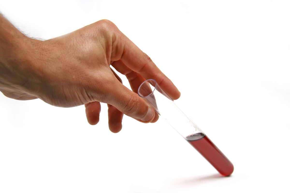 Drug tests might use blood, saliva, sweat, urine, or hair.