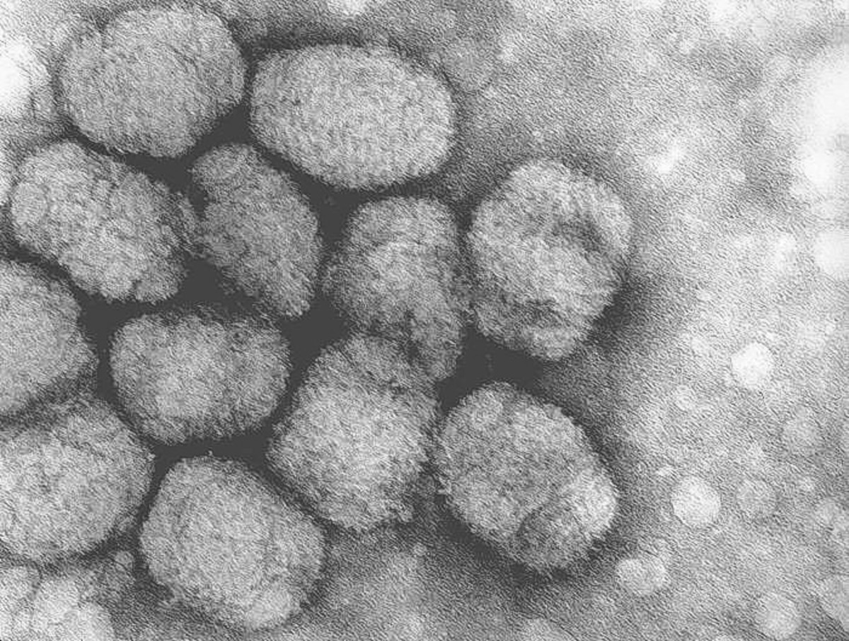 An electron micrograph of the smallpox virus