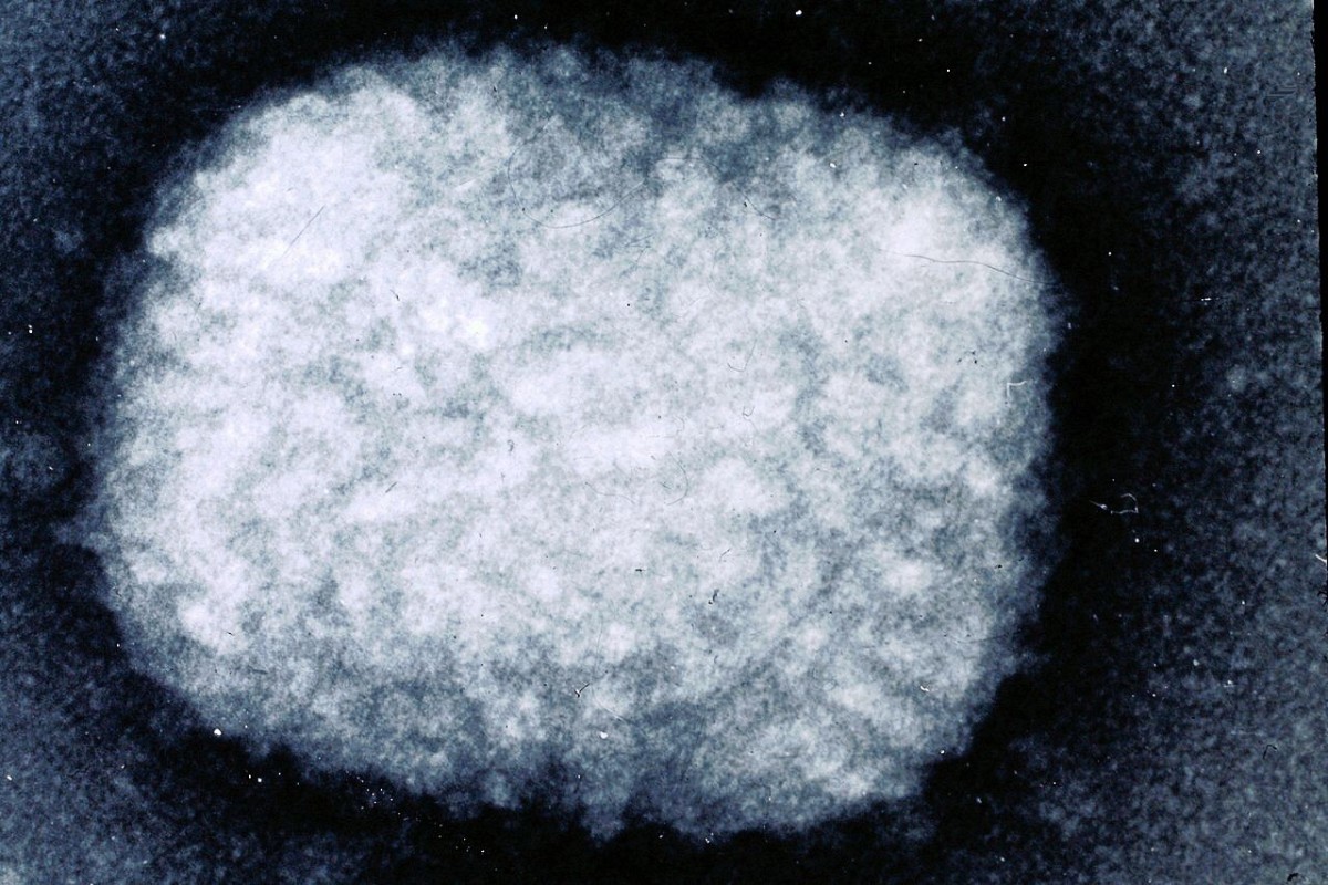 A smallpox virus particle as seen under an electron microscope