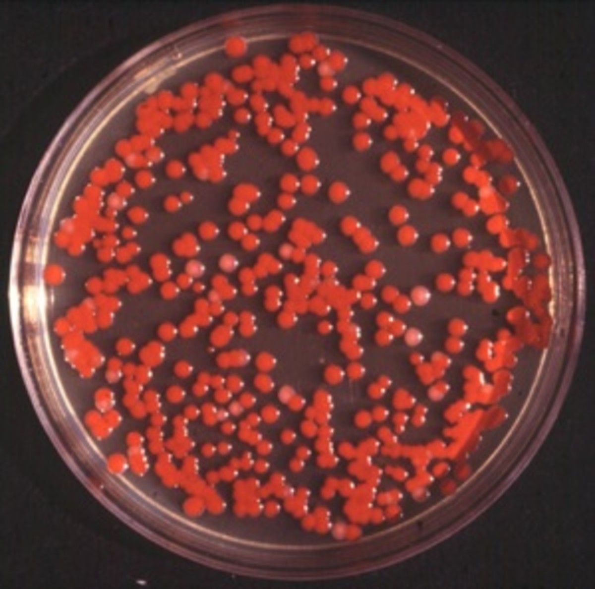 identifying-a-bacteria-in-a-microbiology-lab