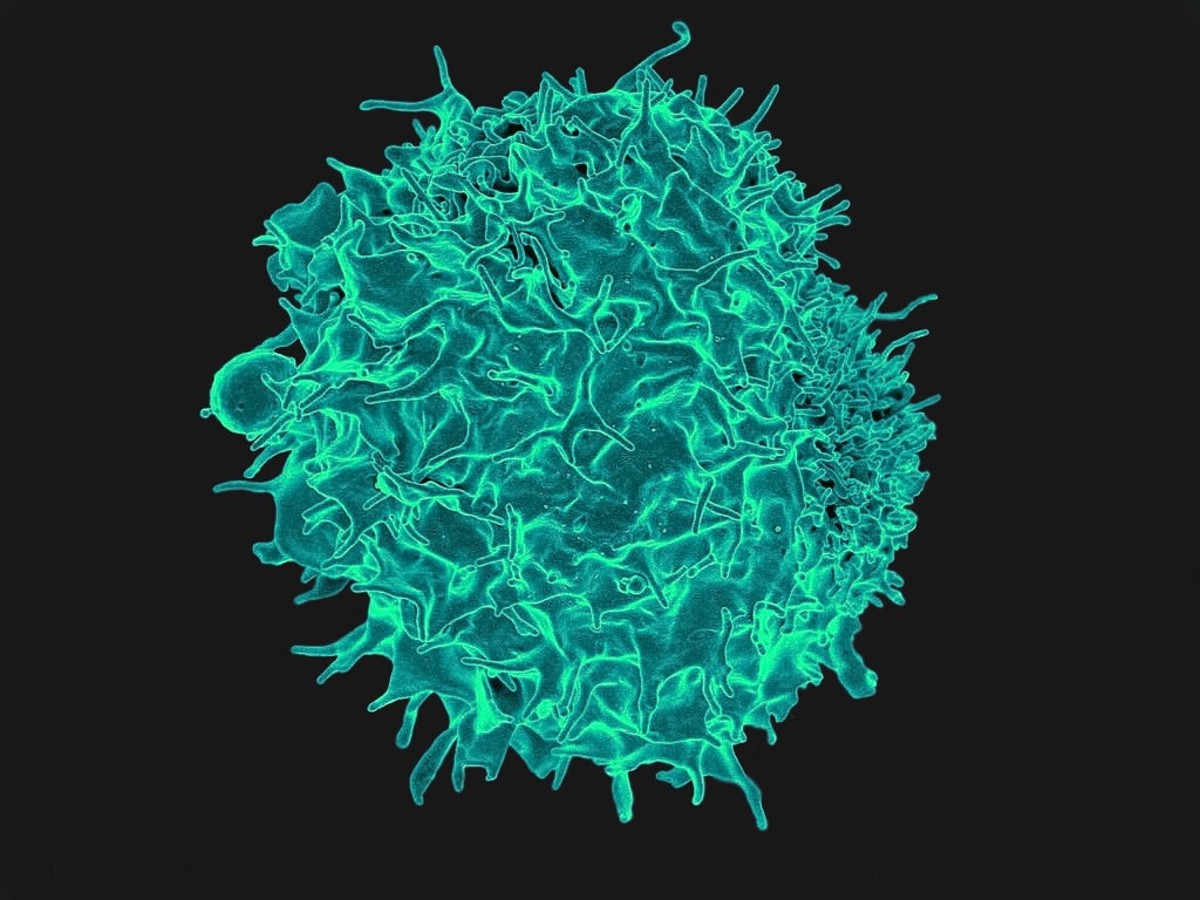This is a T cell, or T lymphocyte, obtained from a healthy person. The photo has been colourized.