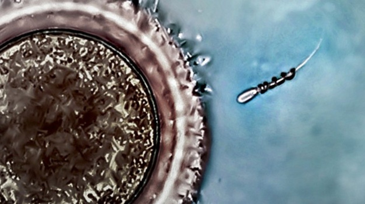 An image showing the sperm being driven towards the egg, using the spermbot.