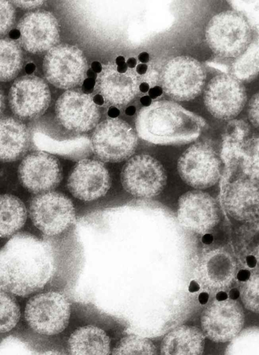 The highly contagious Rotavirus.