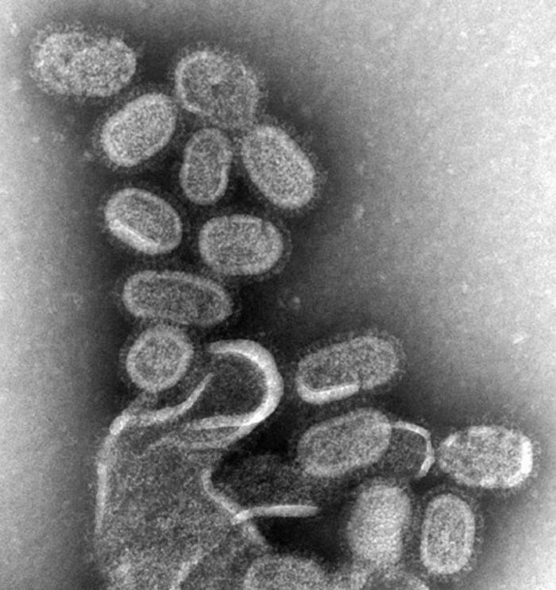 显微镜下的流感(又称“流感”)。